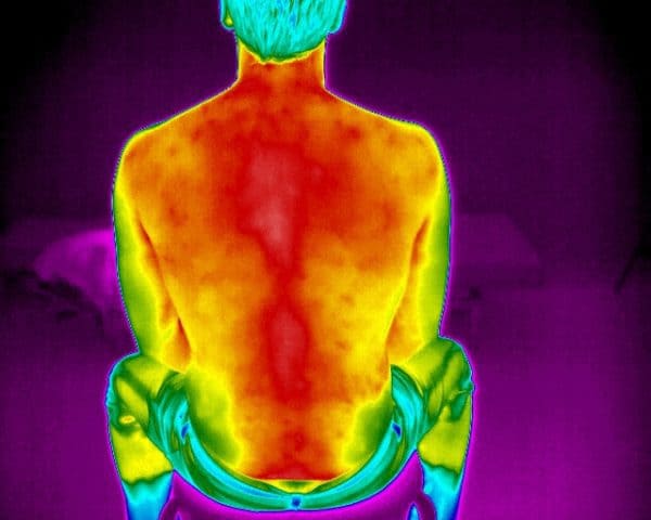 FX-640-Medical-infrared-image-of-mans-spine-600x480-1-1