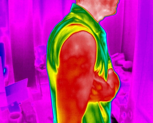 FX-640-Medical-infrared-image-of-shoulder-injury