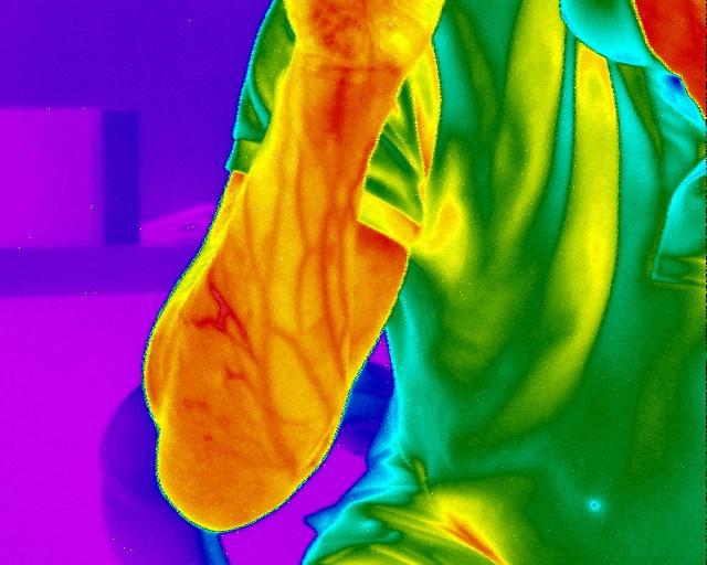 FX-640-Medical-infrared-image-of-veins-in-forearm-1-1