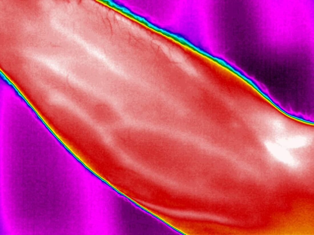FX-640-Medical-infrared-image-shows-blood-veins-conducting-through-skin-1100x824